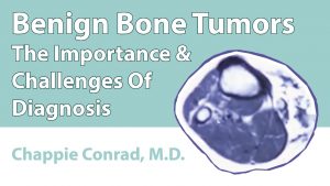 Benign Bone Tumors (The Importance & Challenges Of Diagnosis)